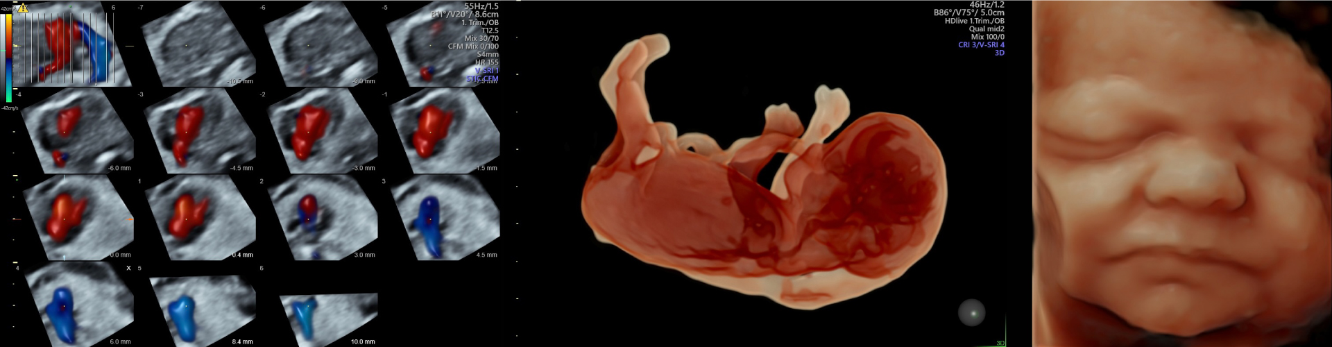 3dprenatal-slider2