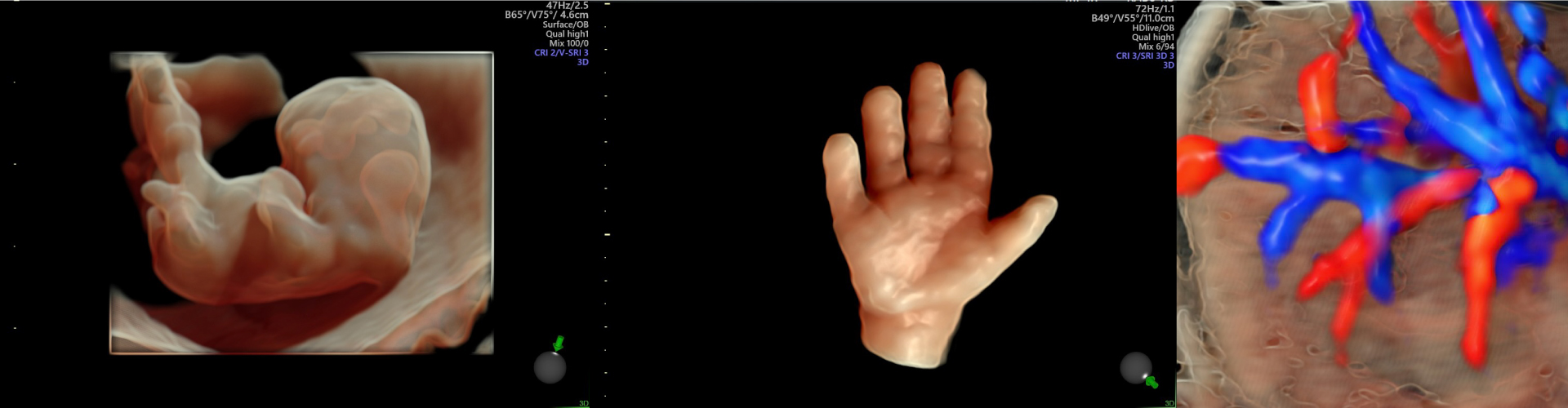 3dprenatal-slider3